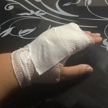 Yuki Caretta Bisiklette Tekrarlayan Tekerlek Arızası Can Güvenliğimizi Tehlikeye Attı