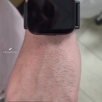 Xiaomi Mi Watch 5 WhatsApp Bildirim Sorunu