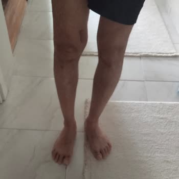 Doğa Sigorta, 2,5 Yıldır Bedeni Hasar Ödememi Yapmıyor Ve Mağduriyetimi Artırıyor