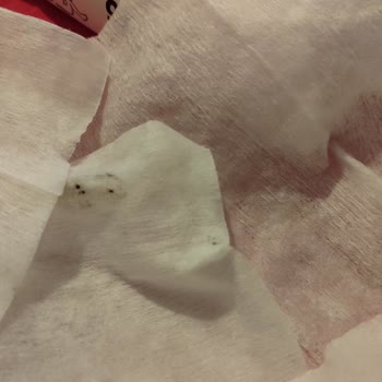 Yeni Açılan Sleepy Bio Natural Islak Mendilde Küf Ve Siyah Leke Sorunu Tekrarlandı