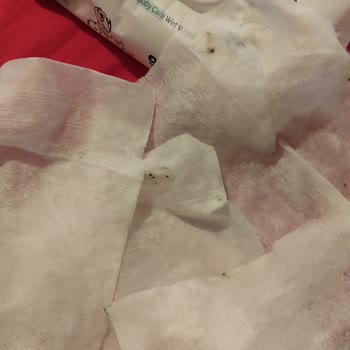 Yeni Açılan Sleepy Bio Natural Islak Mendilde Küf Ve Siyah Leke Sorunu Tekrarlandı