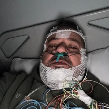 Corpus Sigorta Kazadan Sonra Tazminatım 2 Yıldır Ödenmiyor, Mağduriyetim Artıyor