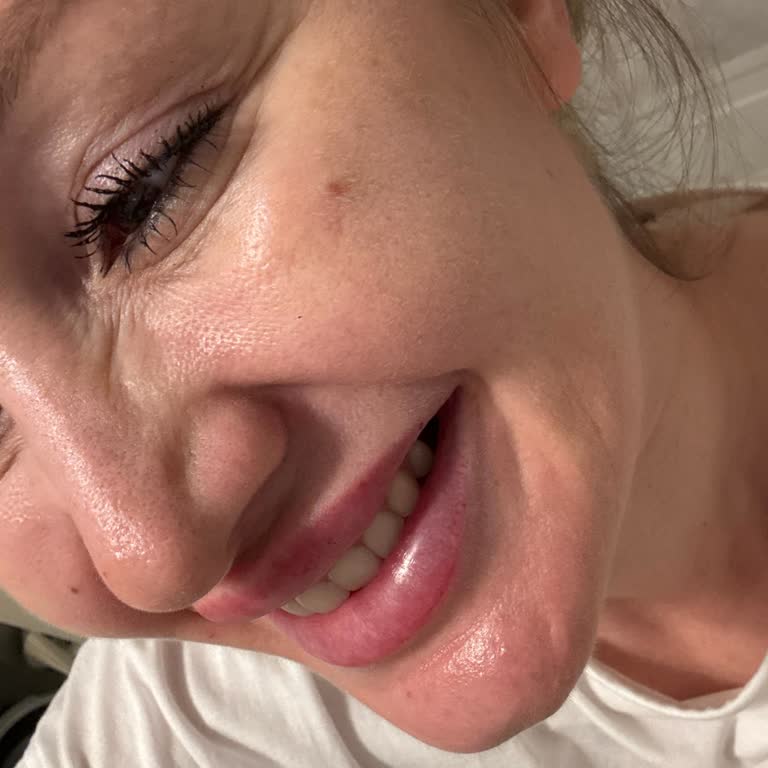 Liva Clinic’te Etkisiz Botox Ve Dolgu Sonrası Hayal Kırıklığı