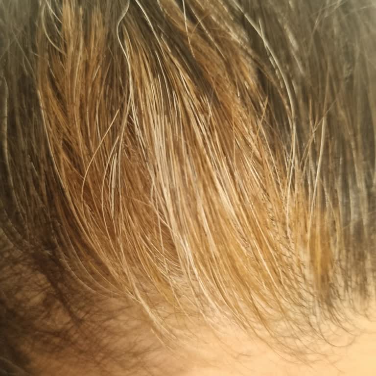 Saç Boyası Kullanımı Sonrası Beklenmeyen Turunculuk Ve Mağduriyet