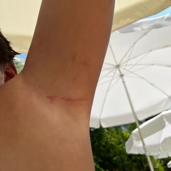 Çocuğuma Havuzda Görevli Tarafından Fiziksel Müdahale