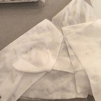 Bebek Islak Mendillerinde Küf Şoku: Sağlık Ve Güven Sorunu