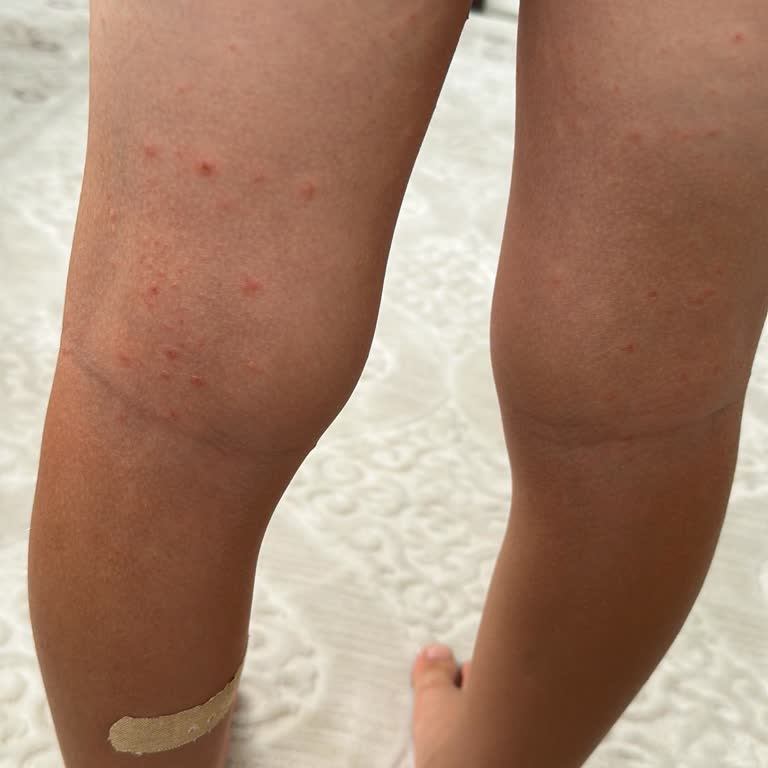 Otelin Hijyen Sorunları Ve Oğlumun Hastalanmasıyla Yaşadığımız Mağduriyet