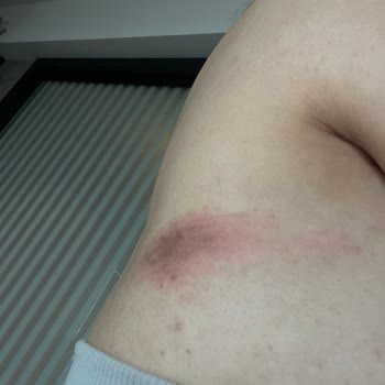 Kusurlu Gelinlik Ve İlgisiz Hizmet Nedeniyle Mağduriyet