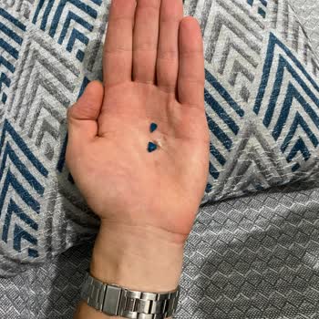 Yeni Alınan Süpürgenin Motor Bağlantı Yerinden Kısa Sürede Kırılması Hayal Kırıklığı