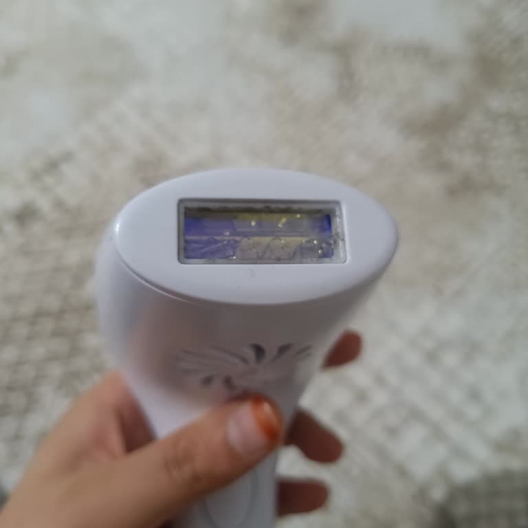 Kiwi Lazer Epilasyon Cihazı Patladı