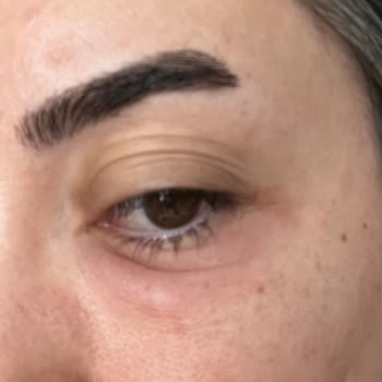 Yves Rocher Göz Altı Kremi Cildimde Şişlik Ve Döküntü Yaptı Güvenim Sarsıldı