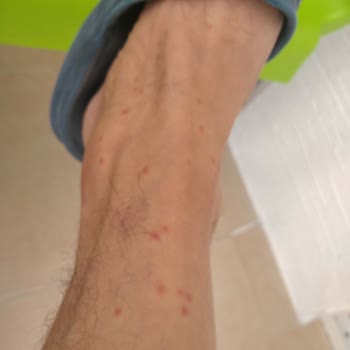 Odalarda Temizlik Ve Hijyen Sorunu, Hizmet Yetersizliği