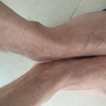 Odalarda Temizlik Ve Hijyen Sorunu, Hizmet Yetersizliği