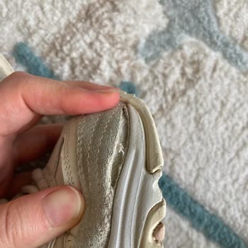 Skechers Ayakkabıda Kısa Sürede Açılma Ve Müşteri Hizmetlerinden Yanıt Alamama