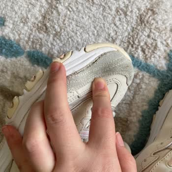 Skechers Ayakkabıda Kısa Sürede Açılma Ve Müşteri Hizmetlerinden Yanıt Alamama