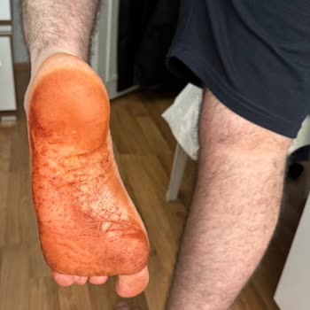 Deri Terlik Ciltte İz Bıraktı, İade Veya Değişim Talebim Karşılanmadı