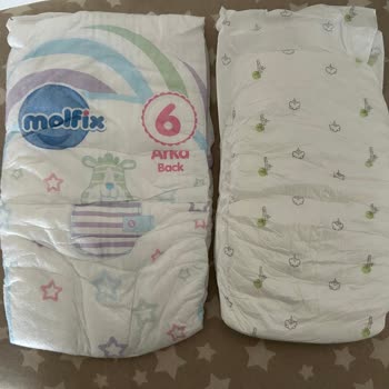 Sleepy Natural 6+ XL Plus Bebek Bezinde Beden Uyumsuzluğu Ve Sızıntı Sorunu