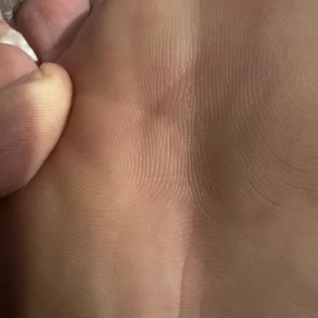 Ayakkabı Dikiş Hatası Nedeniyle Yara Oluştu, Değişim Ve İade Talebim Reddedildi