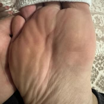 Ayakkabı Dikiş Hatası Nedeniyle Yara Oluştu, Değişim Ve İade Talebim Reddedildi