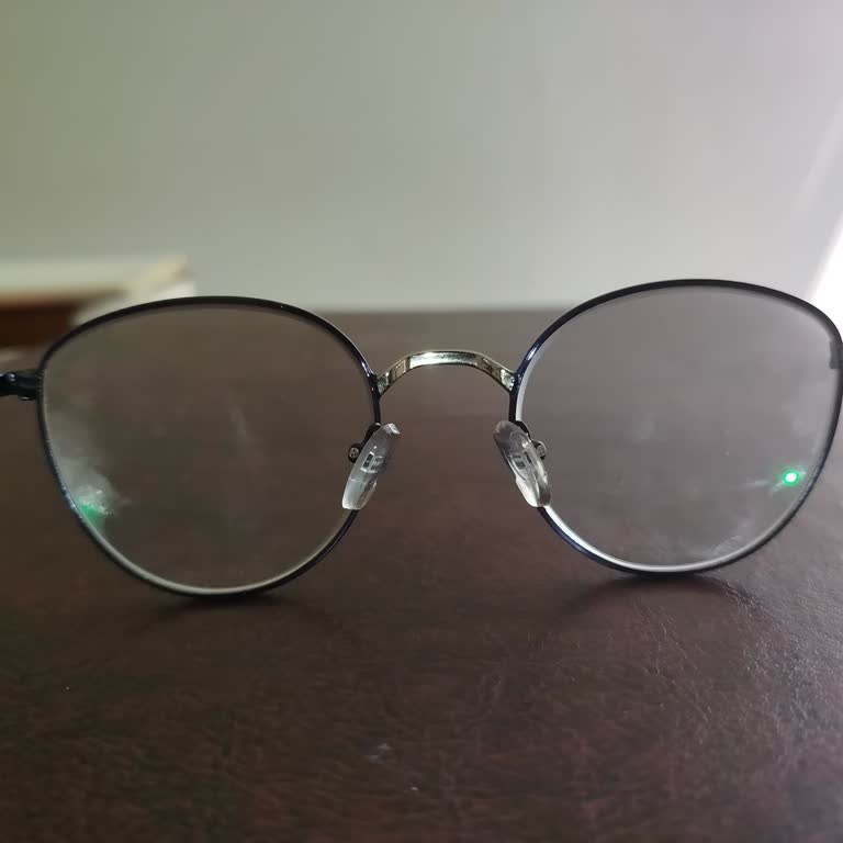 Gözlük Camında Oluşan Leke Ve Yetersiz Mağaza Desteği