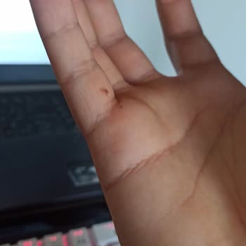 Çikolatada Ölü Böcek Ve Örümcek Ağı Şoku: Hijyen Sorunu