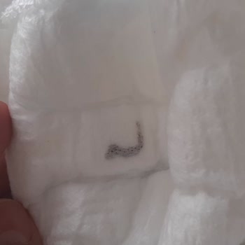 Bebek Bezinde Yabancı Cisim Şoku: Sağlığımız Tehlikede!