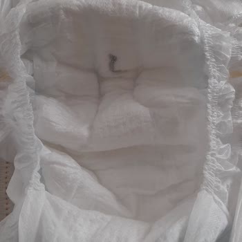 Bebek Bezinde Yabancı Cisim Şoku: Sağlığımız Tehlikede!