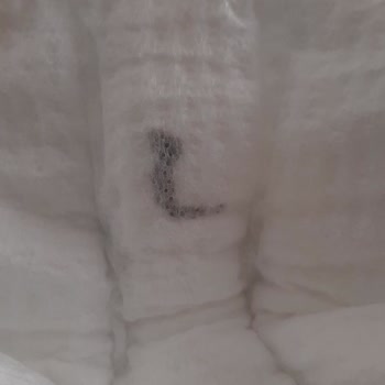 Bebek Bezinde Yabancı Cisim Şoku: Sağlığımız Tehlikede!