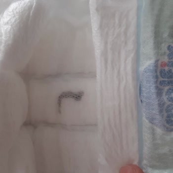 Bebek Bezinde Yabancı Cisim Şoku: Sağlığımız Tehlikede!