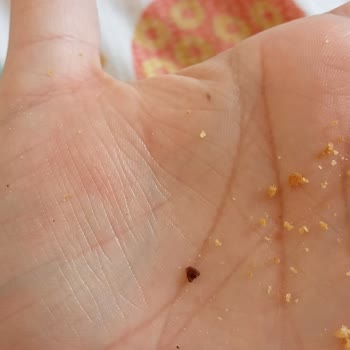 Torku Peynirde Taş Benzeri Yabancı Madde Şoku