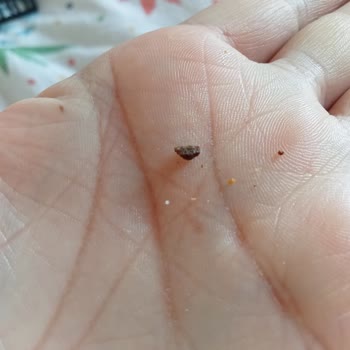 Torku Peynirde Taş Benzeri Yabancı Madde Şoku