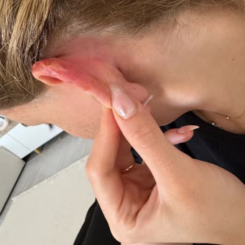 Ebru Dinç Hair Studio Yaşadığım Mağduriyet