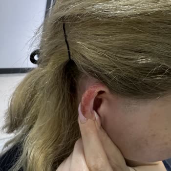 Ebru Dinç Hair Studio Yaşadığım Mağduriyet