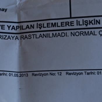 Yeni Alınan Bluetooth Kulaklıkta Sürekli Ses Kesintisi Ve Servis Çözüm Sunmuyor