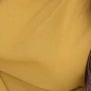 Lekeli Ve Kokulu Elbise İadesi Reddedildi Müşteri Hizmetleri Çözüm Sunmuyor