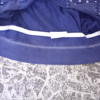 OMO Deterjan Renkli Kıyafetlerimi Yıprattı Ve Büyük Maddi Zarara Uğradım