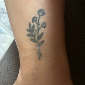 Aris Güzellik Merkezleri Lazer Epilasyon Sonrası Dövmemde Yanık Ve Kalıcı Hasar Oluştu