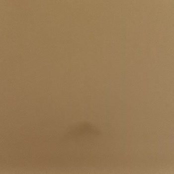 Hijyen Sorunları Ve Haksız Ücret Kesintisiyle Hayal Kırıklığı