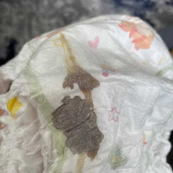 Molfix Bebek Bezinde Tekrarlayan Bilinmeyen Malzeme Problemi