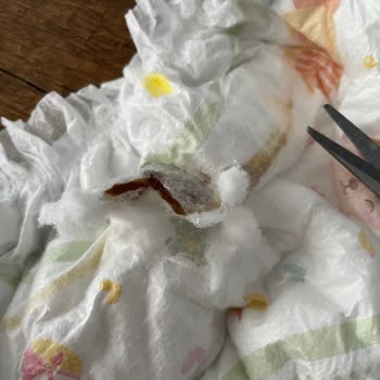 Molfix Bebek Bezinde Tekrarlayan Bilinmeyen Malzeme Problemi