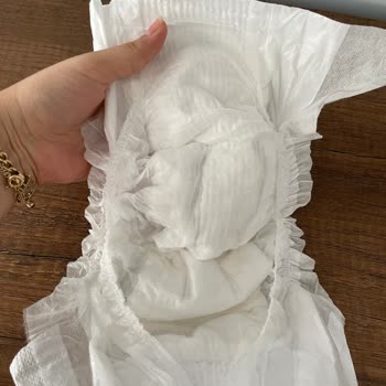 Molfix Bebek Bezinde Tekrarlayan Bilinmeyen Malzeme Problemi