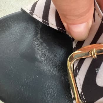 İki Kez Giyilen Terlikte Ciddi Soyulma Ve Mağazadan Çözüm Sunulmaması