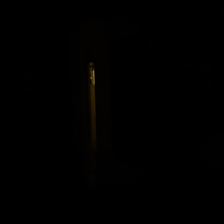 Elektrik Hattındaki Tehlikeye Ciddi Müdahale Bekliyoruz!