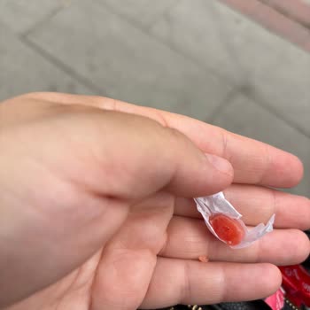 Aldığım Olips Şeker Paketinden Eksik Şekerler Çıktı, Açıklama Ve Değişim Bekliyorum