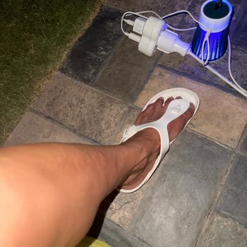 Aldığım Ürün Cildimde Kaşıntı Ve Şişlik Yaptı Müşteri Hizmetleri Dönüş Yapmıyor