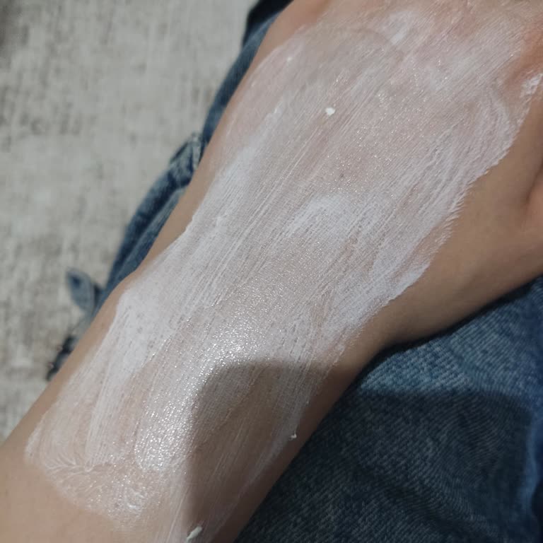 Aldığım Güneş Kremi Cildimde Sorunlara Yol Açtı, Değişim Veya İade Talep Ediyorum