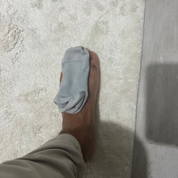 Satın Alınan Çorapların Kısa Sürede Deforme Olması Ve İade Talebi