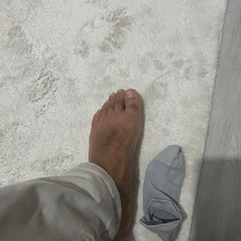 Satın Alınan Çorapların Kısa Sürede Deforme Olması Ve İade Talebi