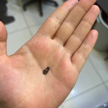 Kek İçinden Çıkan Sivri Plastik Parçası Hayatımı Tehlikeye Attı