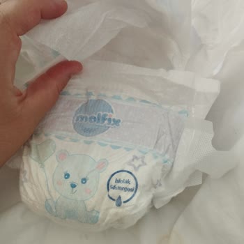 Molfix Bebek Bezlerinde Tela Sorunu Ve Rahatsızlık Yaşanması